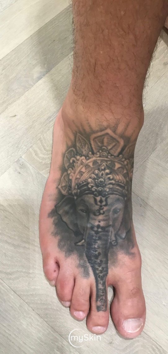 Elephant tattoo before treatment