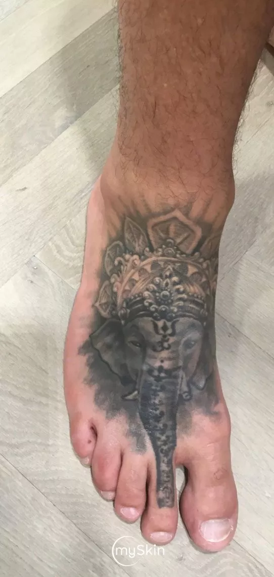 Elephant tattoo before treatment