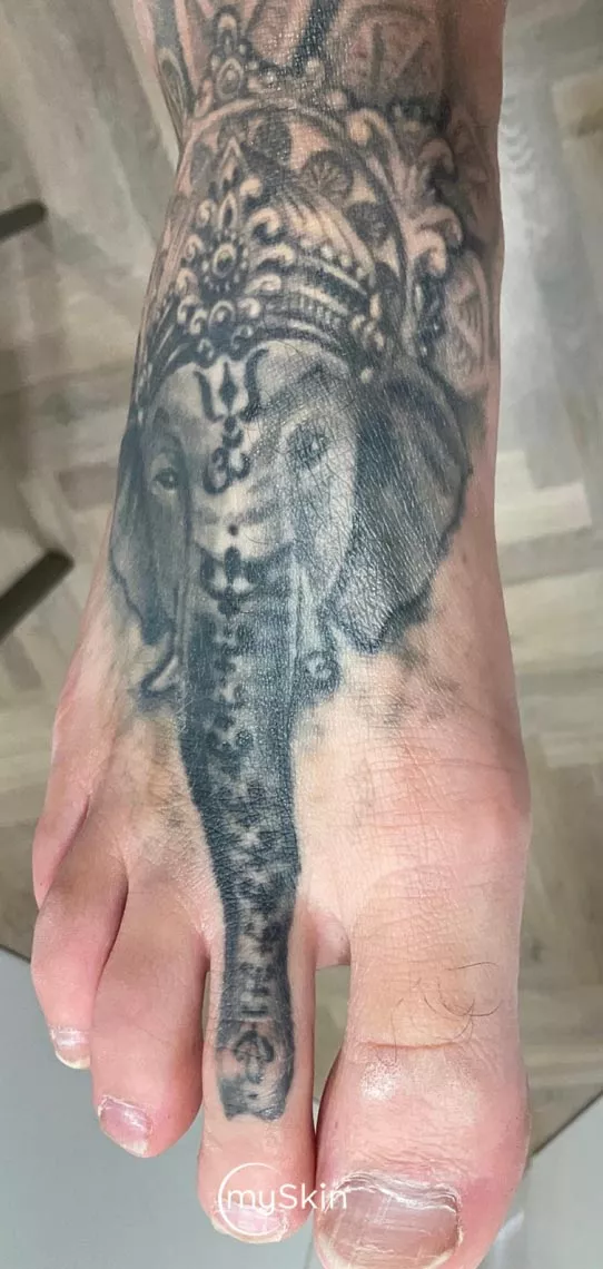Elephant tattoo after first treatment