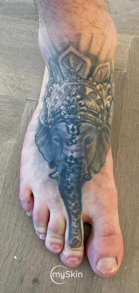 Elephant tattoo after second treatment