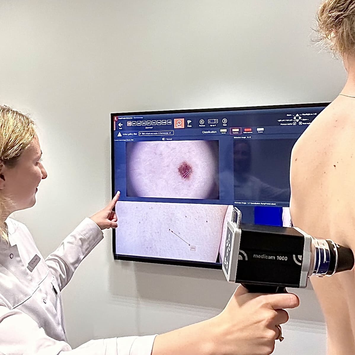 Patient having skin check for skin cancer