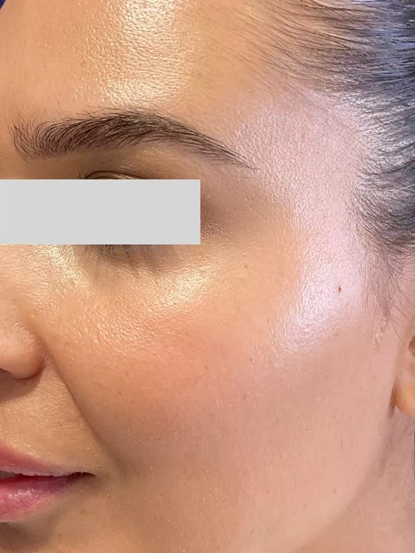 Dry skin on face