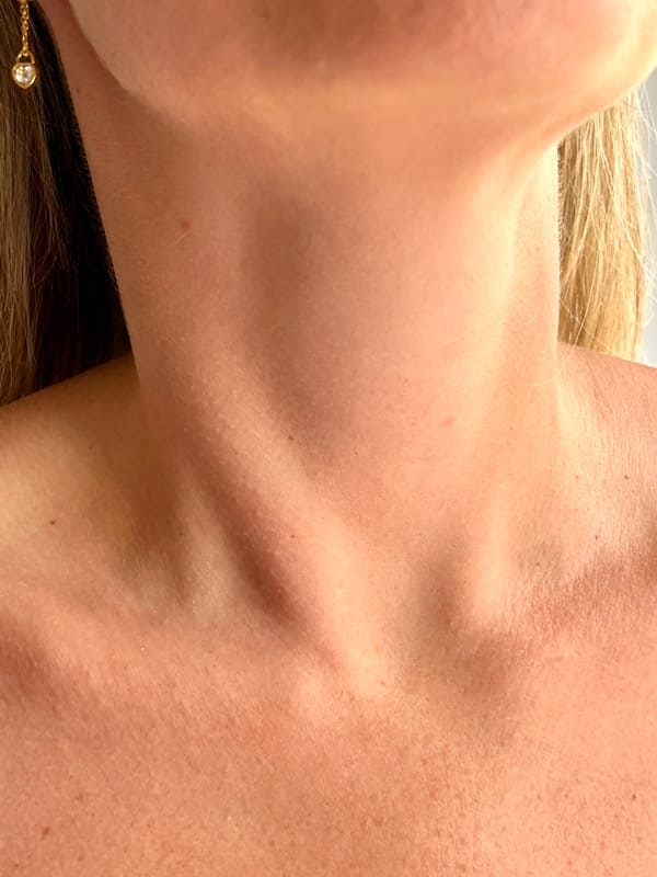 Dry skin in neck region