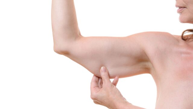 Rejuvenation for Your Arms at mySkin Mallorca