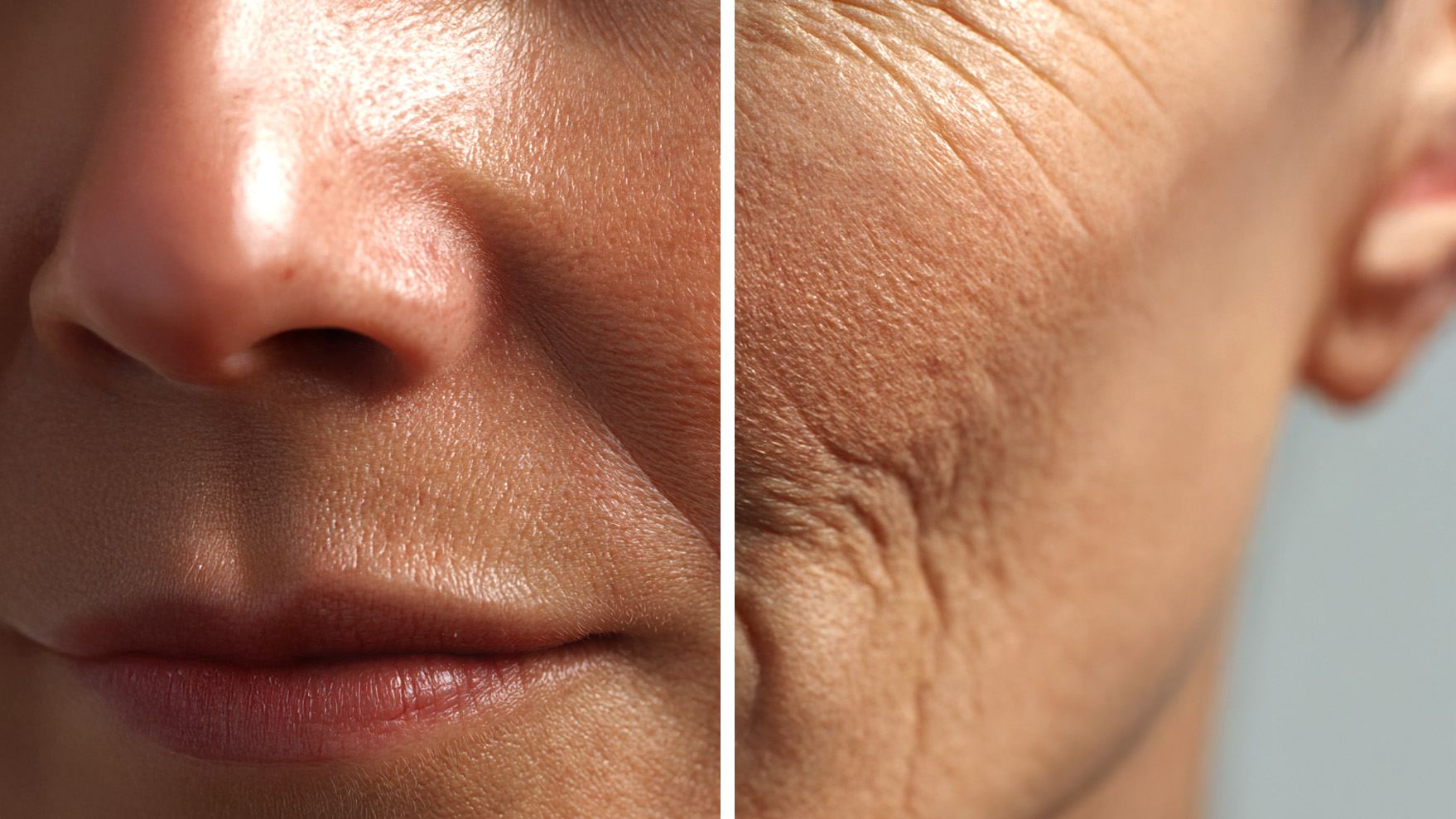 Comparison of smooth youthful skin and mature skin with visible wrinkles