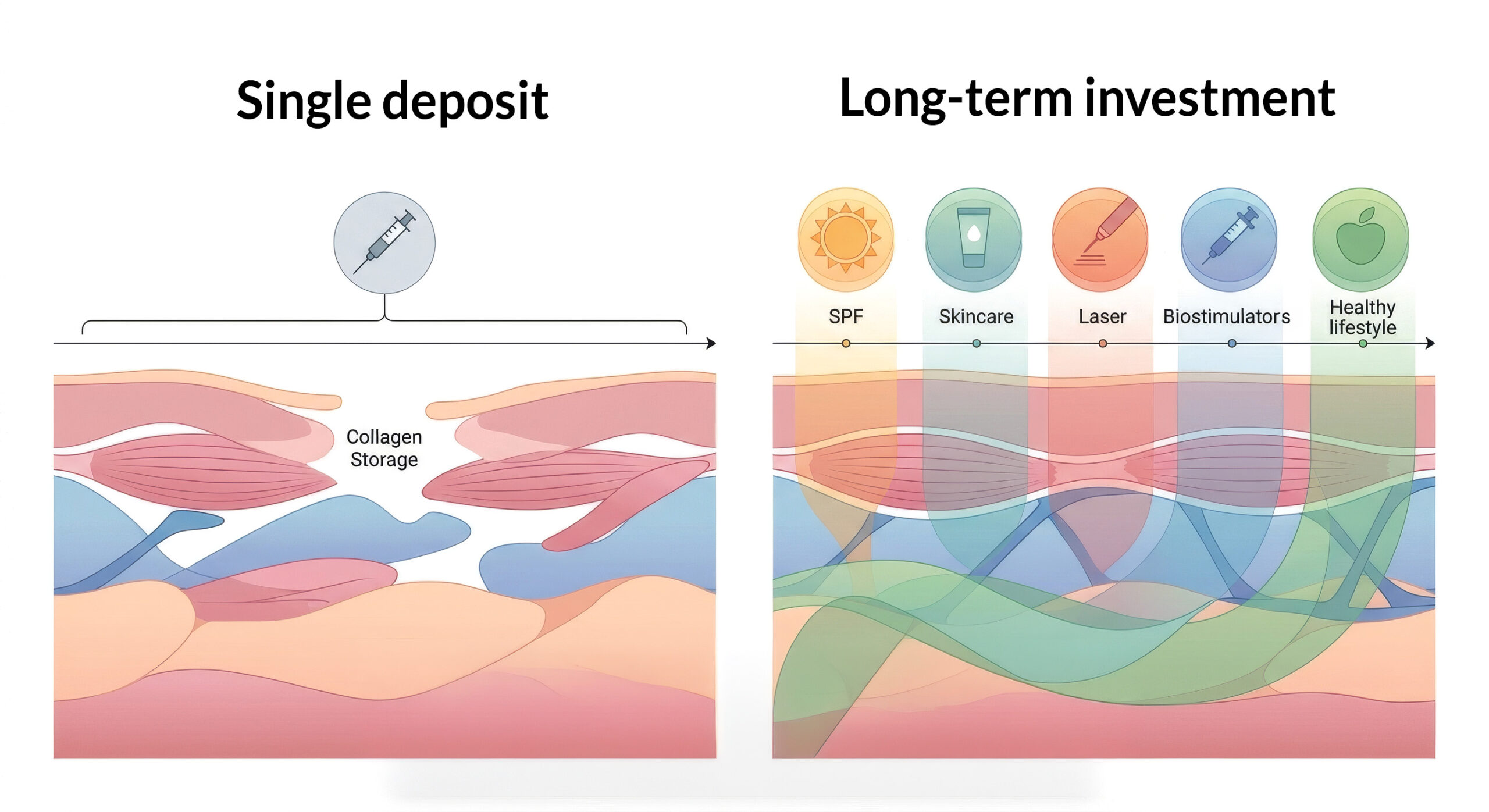 Medical illustration comparing a single collagen-stimulating treatment with long-term collagen banking through preventive skin care and regenerative treatments.