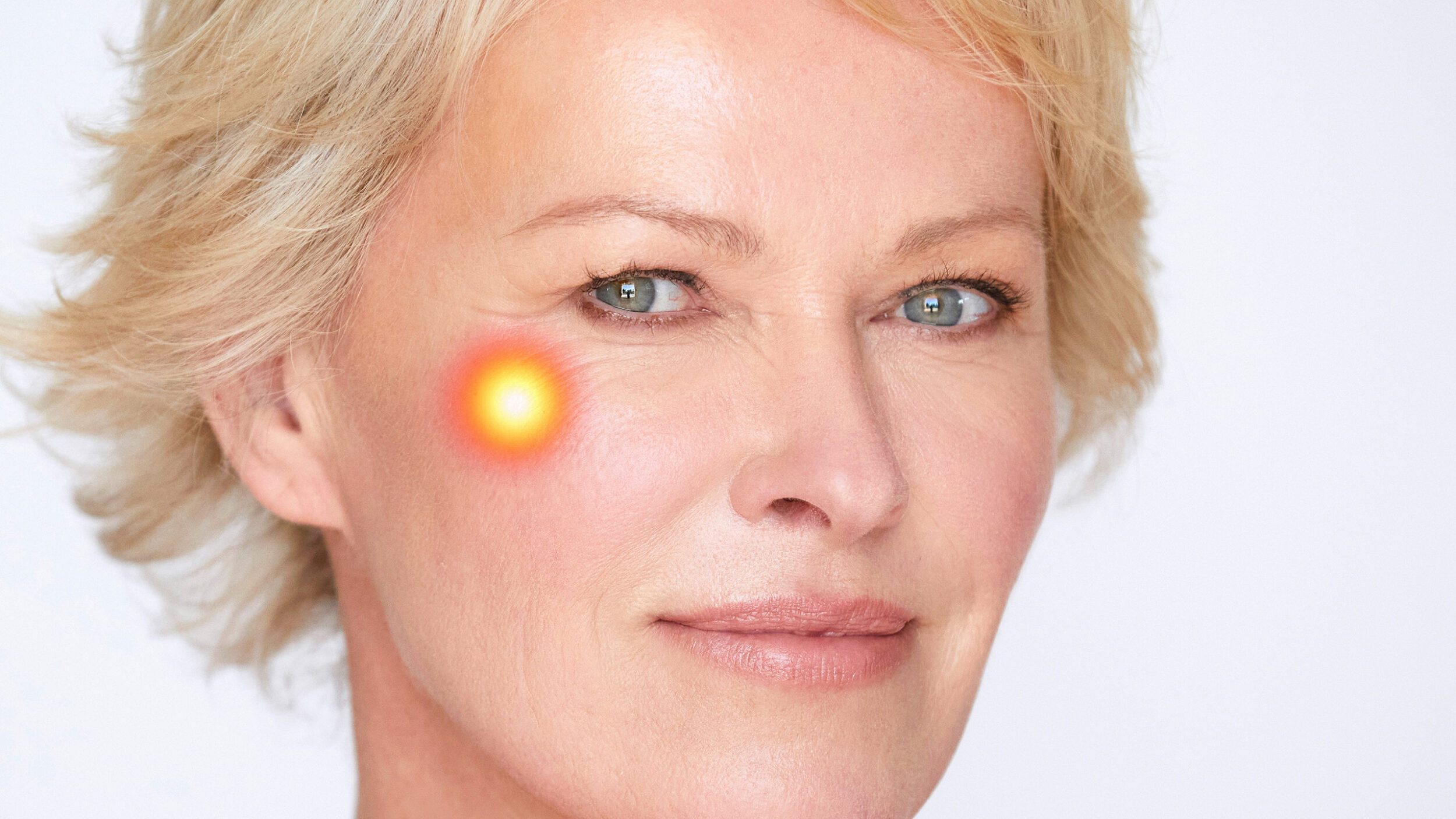Mature woman with highlighted cheek area representing Endolift® facial tightening treatment.