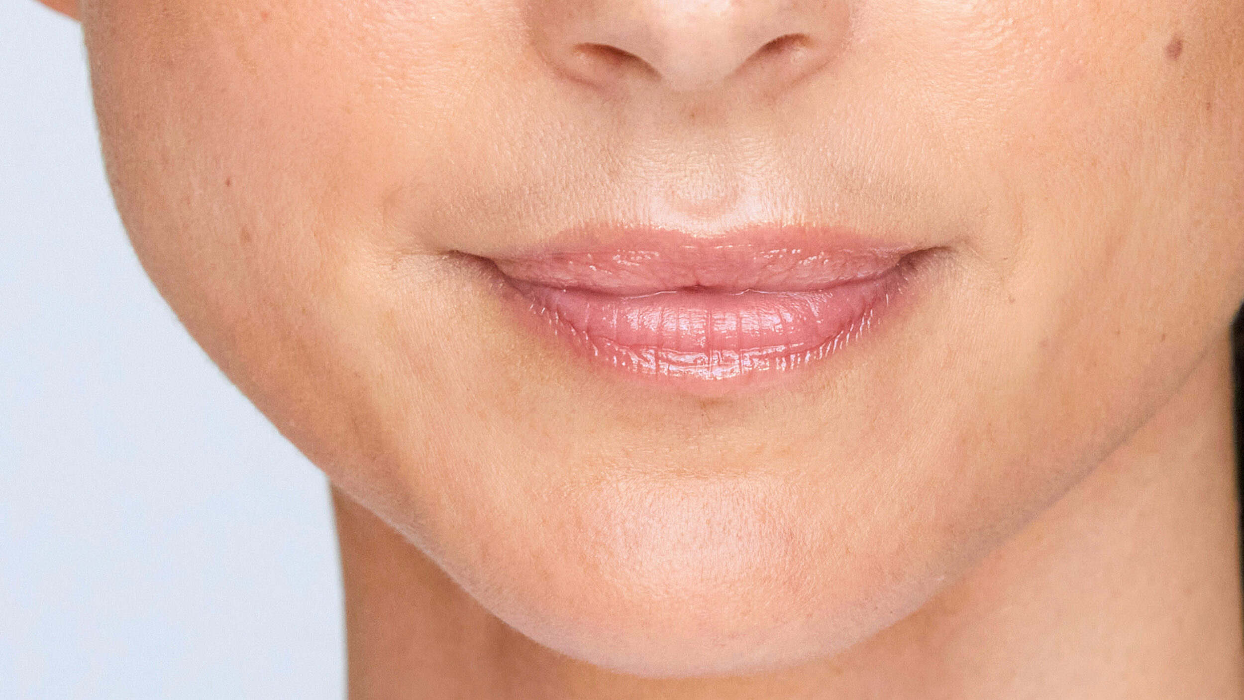 Close-up of naturally enhanced lips after hyaluronic acid lip filler treatment.