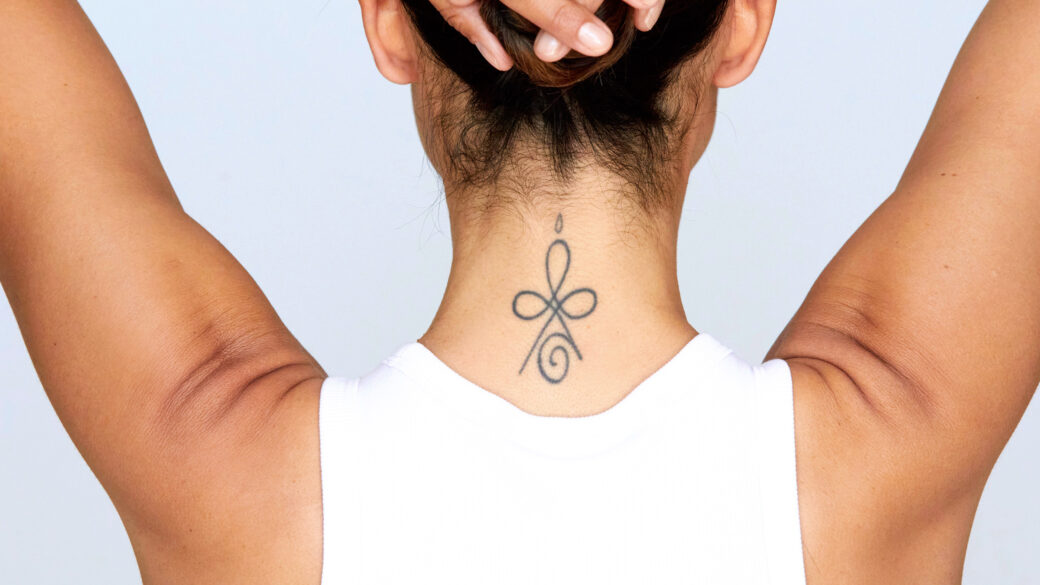 Back of the neck with tattoo before laser tattoo removal treatment.